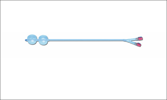 孕晚期宮頸條件差難順產(chǎn)？球囊導(dǎo)管幫你 “軟化宮頸”，輕松鋪好順產(chǎn)路